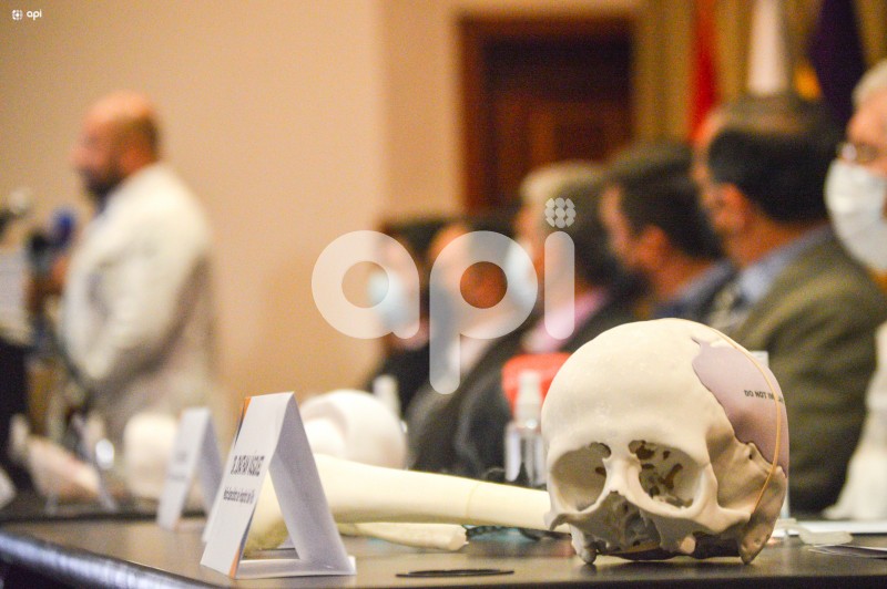 CUENCA-IMPLANTES-OSEOS