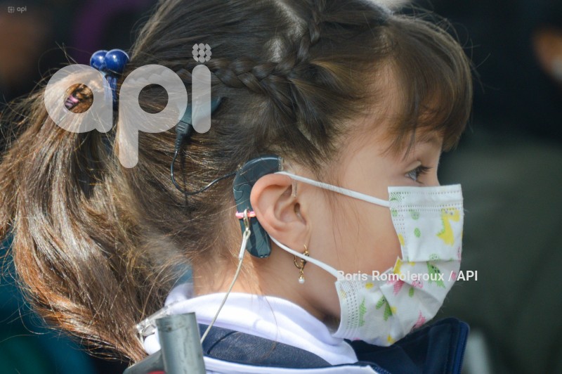 CUENCA-PROYECTO-IMPLANTES-COCLEARES