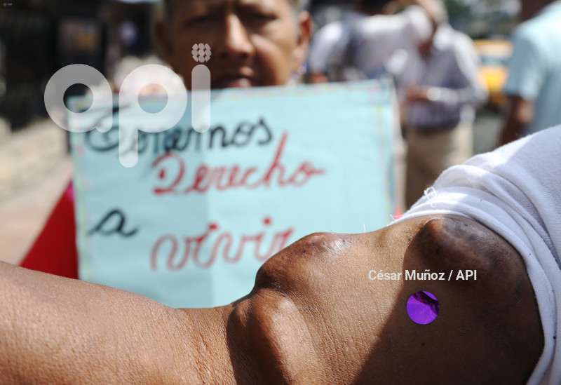 GYE-PLANTON PACIENTES RENALES