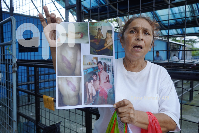 GYE-TUBERCULOSIS EN LA PENI