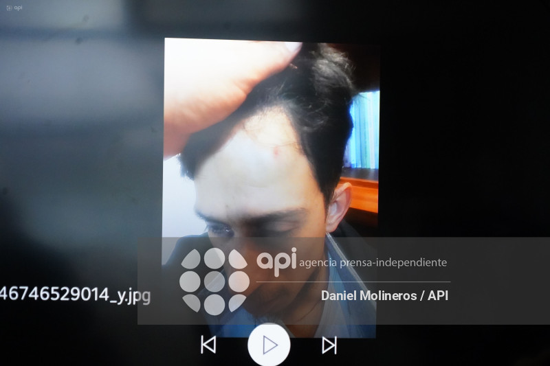 RP  ATAQUE CENTRO ECUATORIANO IRANI